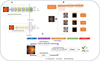 Combining transfer learning with retinal lesion features for accurate detection of diabetic retinopathy